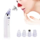 Вакуумний очищувач Derma suction DS Vacuum для професійного чищення шкіри та пор обличчя - легкий компактний зручний прилад у використанні + 4 насадки, Білий - зображення 1