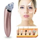 Вакуумный очиститель кожи Menqahahayd XN-8030 Pink - изображение 7