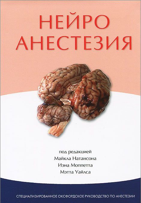 

Нейроанестезия