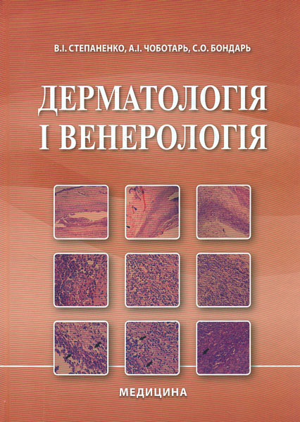 

Дерматологія і венерологія: підручник - Степаненко В.І.