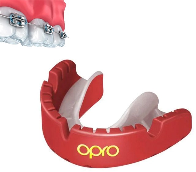 

Капа Opro Gold Braces Red/Pearl (002227008)