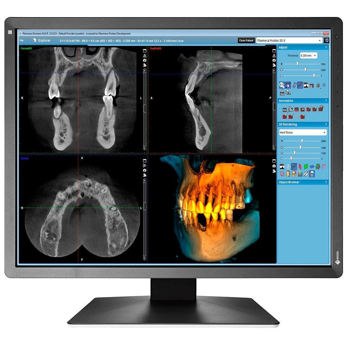 

Монитор EIZO MX216-SB