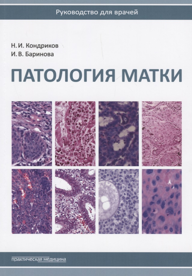 

Патология матки. Руководство для врачей