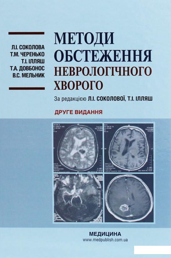 

Методи обстеження неврологічного хворого (1224387)