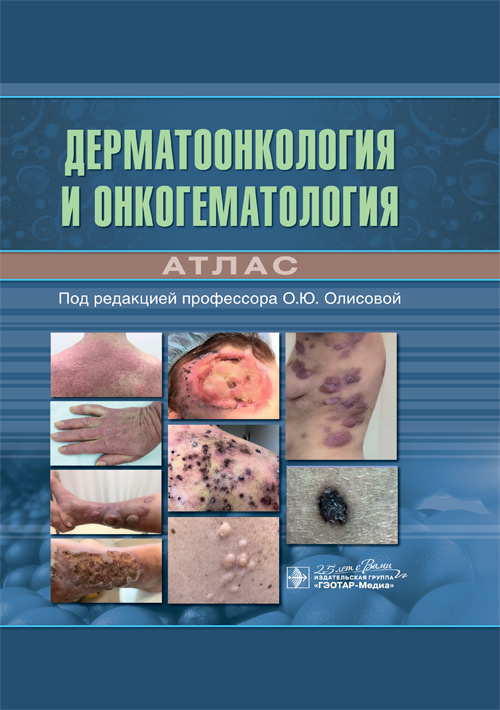 

Дерматоонкология и онкогематология. Атлас
