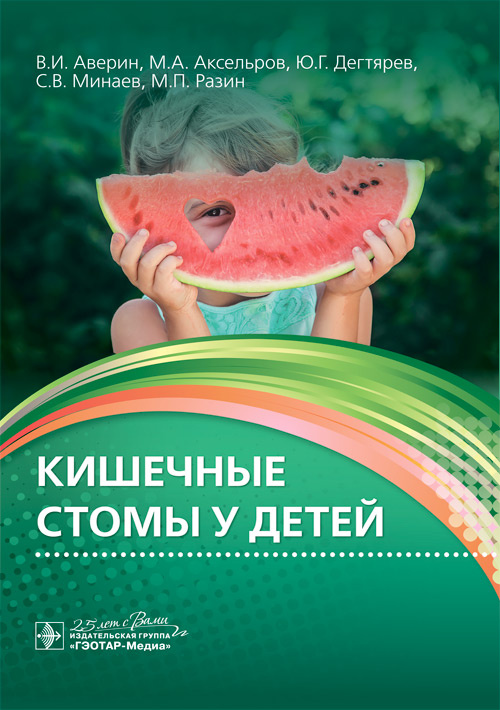 

Кишечные стомы у детей