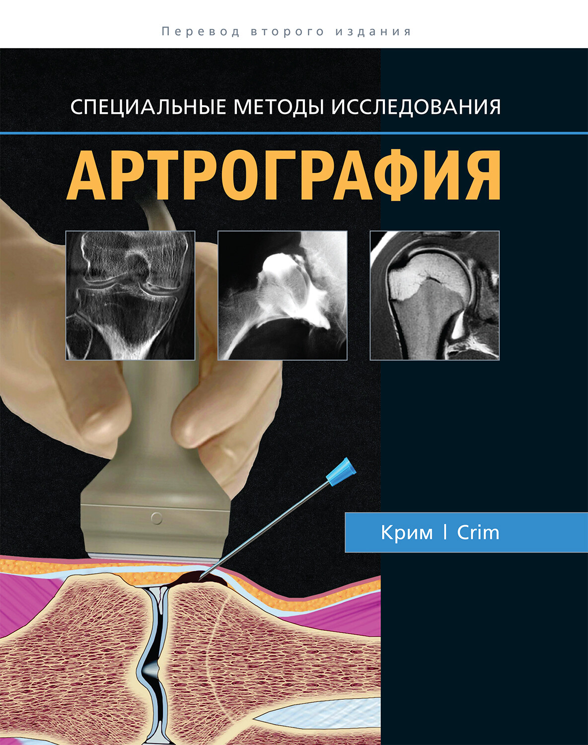 

Артрография