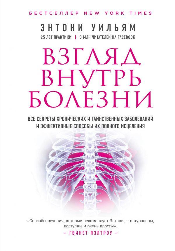 

Взгляд внутрь болезни-Ентоні Уїльям-(978-617-7808-32-8)