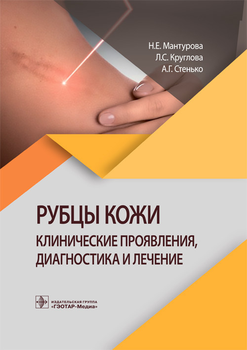 

Рубцы кожи. Клинические проявления, диагностика и лечение - Мантурова Н.Е., Круглова Л.С., Стенько А.Г. (978-5-9704-6050-4)