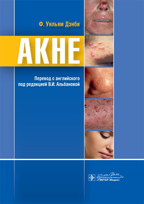

Акне - Ф. Уильям Дэнби (978-5-9704-5531-9)