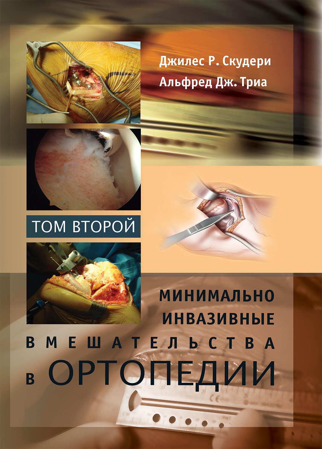

Минимально инвазивные вмешательства в ортопедии: в 2-х томах. Том 2 - Джилес Р. Скудери (978-5-9963-1857-5)