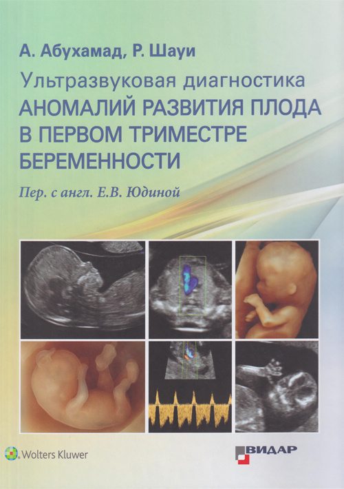 

Ультразвуковая диагностика аномалий развития плода в первом триместре беременности - А.З. Абухамад, Р. Шауи (978-5-88429-251-2)