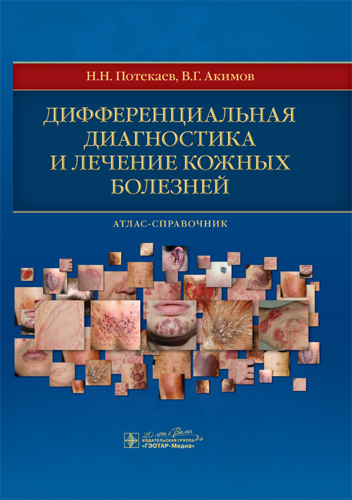 

Дифференциальная диагностика и лечение кожных болезней - Потекаев Н.Н., Акимов В.Г. (978-5-9704-3555-7)