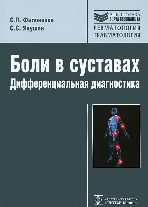 

Боли в суставах. Дифференциальная диагностика (1019483)