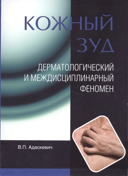 

Кожный зуд. Дерматологический и междисциплинарный феномен (729998)