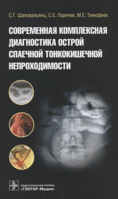 

Современная комплексная диагностика острой спаечной тонкокишечной непроходимости