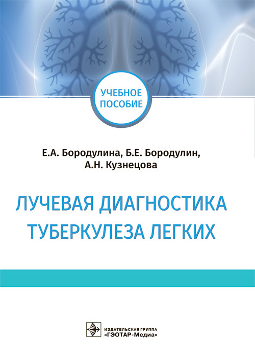 

Лучевая диагностика туберкулеза легких. Учебное прсобие