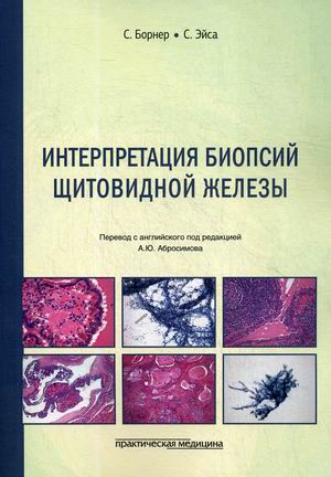

Интерпретация биопсий щитовидной железы (4296692)