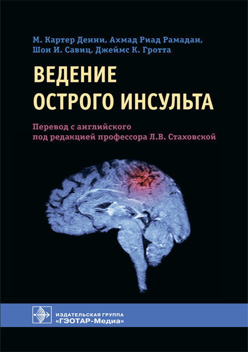 

Ведение острого инсульта