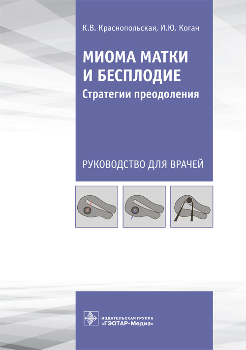 

Миома матки и бесплодие. Стратегии преодоления
