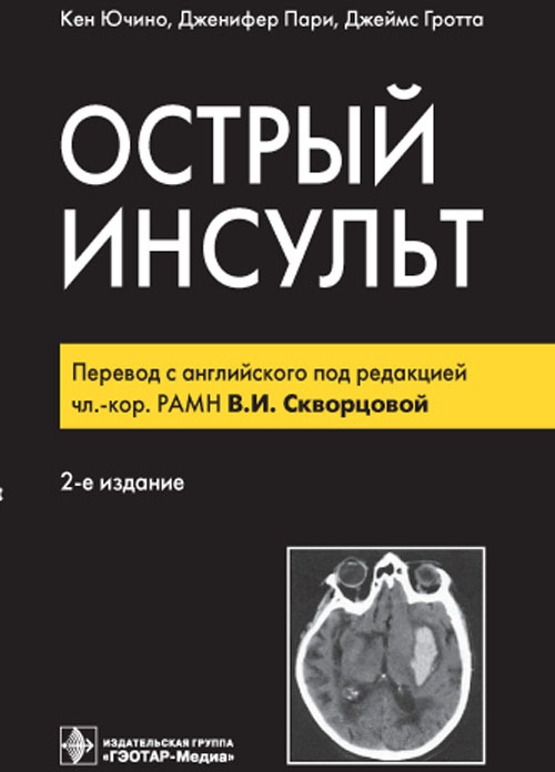 

Острый инсульт (513947)
