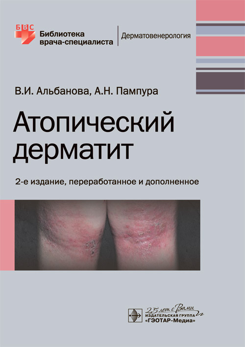 

Атопический дерматит (4219624)