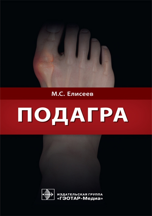 

Подагра (1807528)
