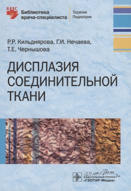 

Дисплазия соединительной ткани (3620385)