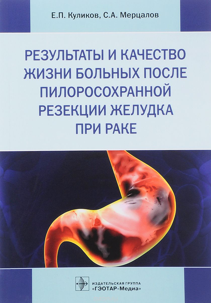 

Результаты и качество жизни больных после пилоросохранной резекции желудка при раке