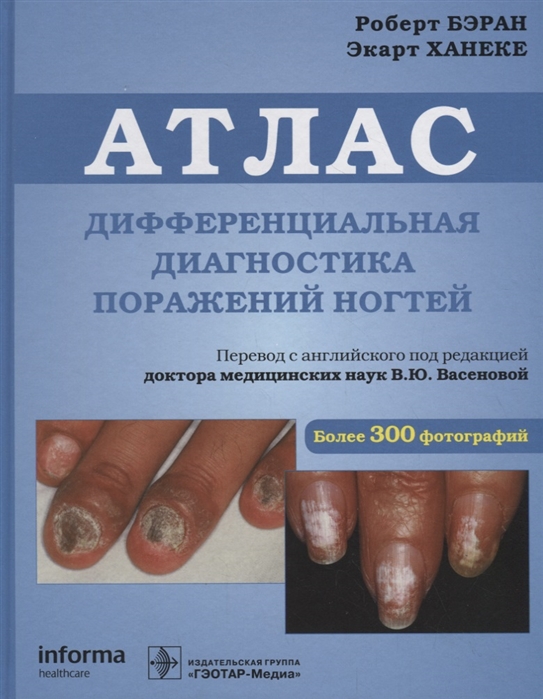 

Дифференциальная диагностика поражений ногтей. Атлас (1816977)