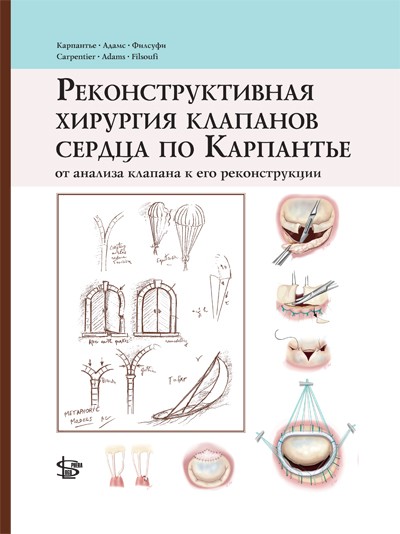 

Реконструктивная хирургия клапанов сердца по Карпантье