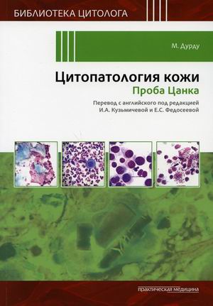 

Цитопатология кожи. Проба Цанка (4349444)