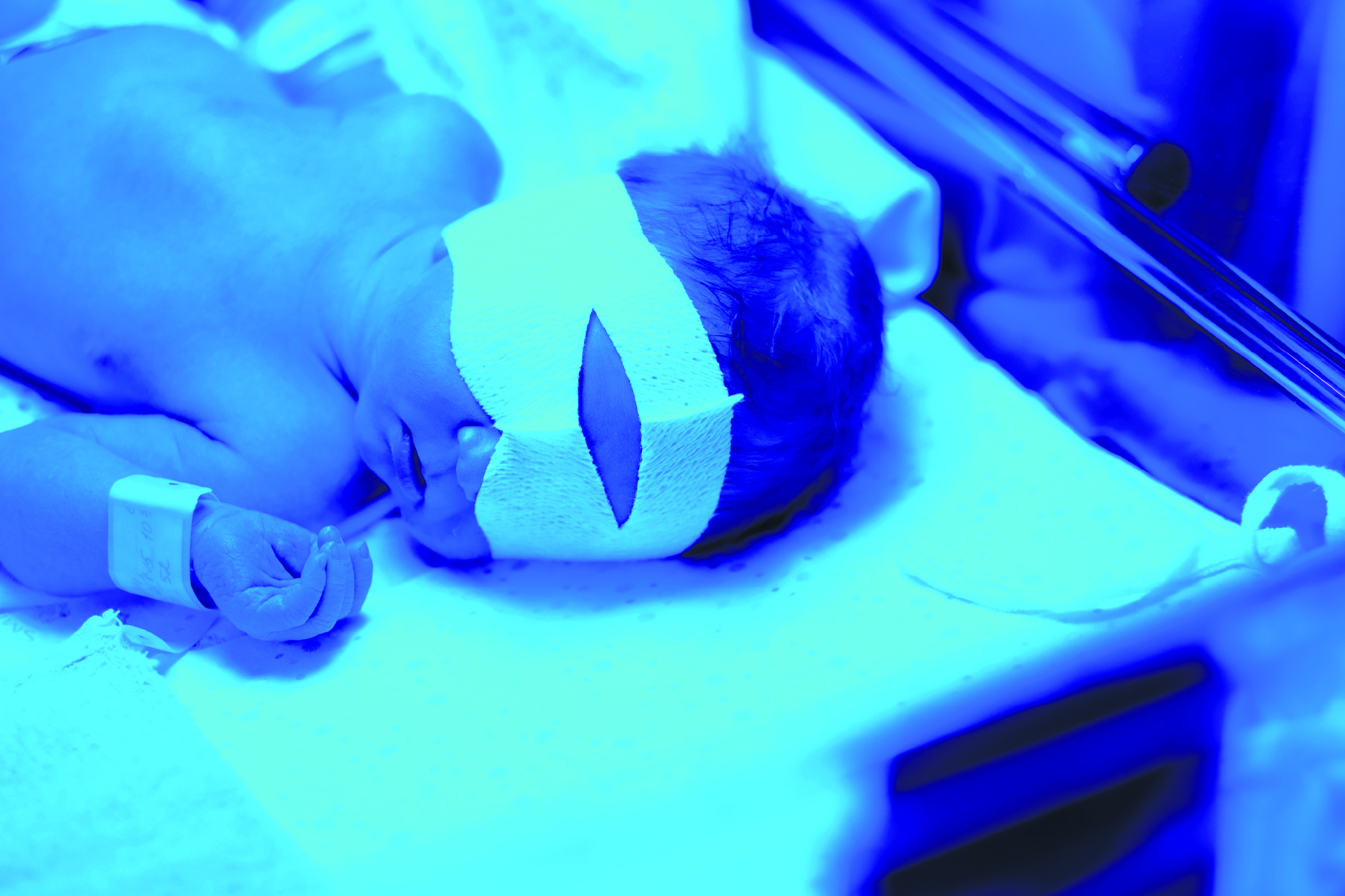 Новорождённый под ультрафиолетом