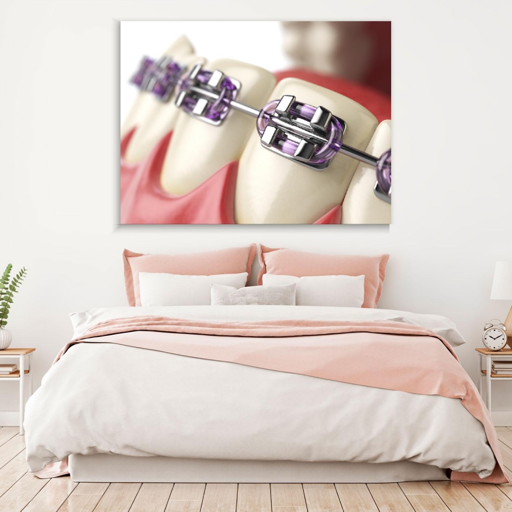 

Картина на холсте Стоматология Teeth With Purple Braces 50х65 см.
