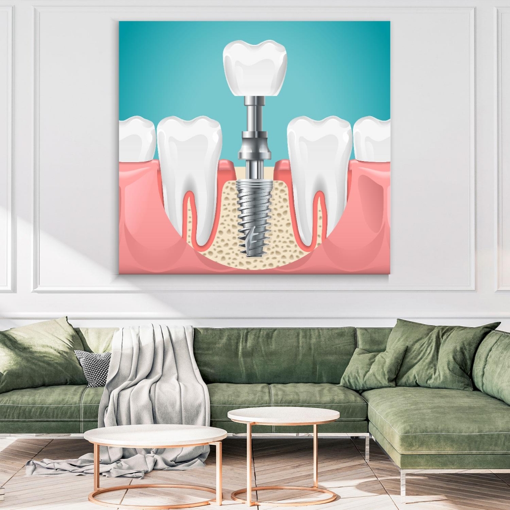 

Картина на холсте Стоматология Dental Surgery 60х60 см.