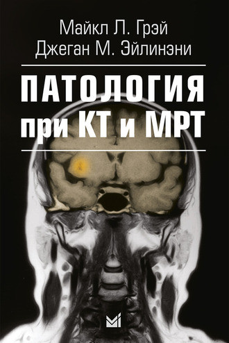 

Грэй М.Л. Патология при КТ и МРТ 2-е издание 2017 год (978-5-00030-425-9) Изд. МЕДпресс-информ