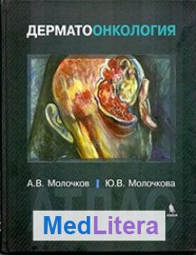 

Молочков А. В. Дерматоонкология. Атлас (978-5-9518-0642-0) Изд. Бином