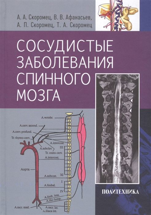 

Скоромец А., Афанасьев В. Сосудистые заболевания спинного мозга. Руководство для врачей (978-5-7325-1131-4) Изд. Политехника