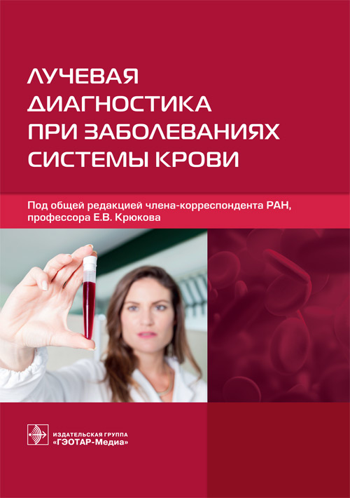 

Лучевая диагностика при заболеваниях системы крови