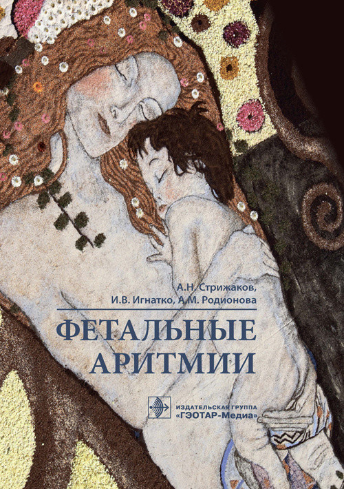 

Фетальные аритмии