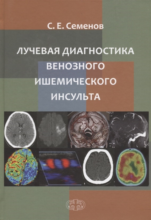 

Лучевая диагностика венозного ишемического инсульта
