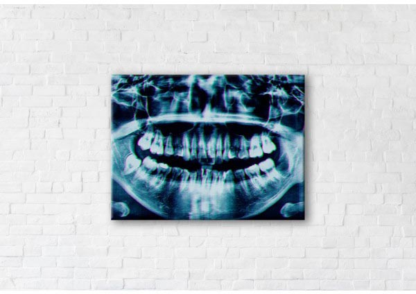 

Картина на холсте IBR X-ray Image 45x60 см