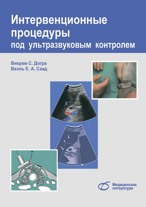 

Догра В.С. Интервенционные процедуры под ультразвуковым контролем (978-5-89677-184-5) Изд. Медицинская литература