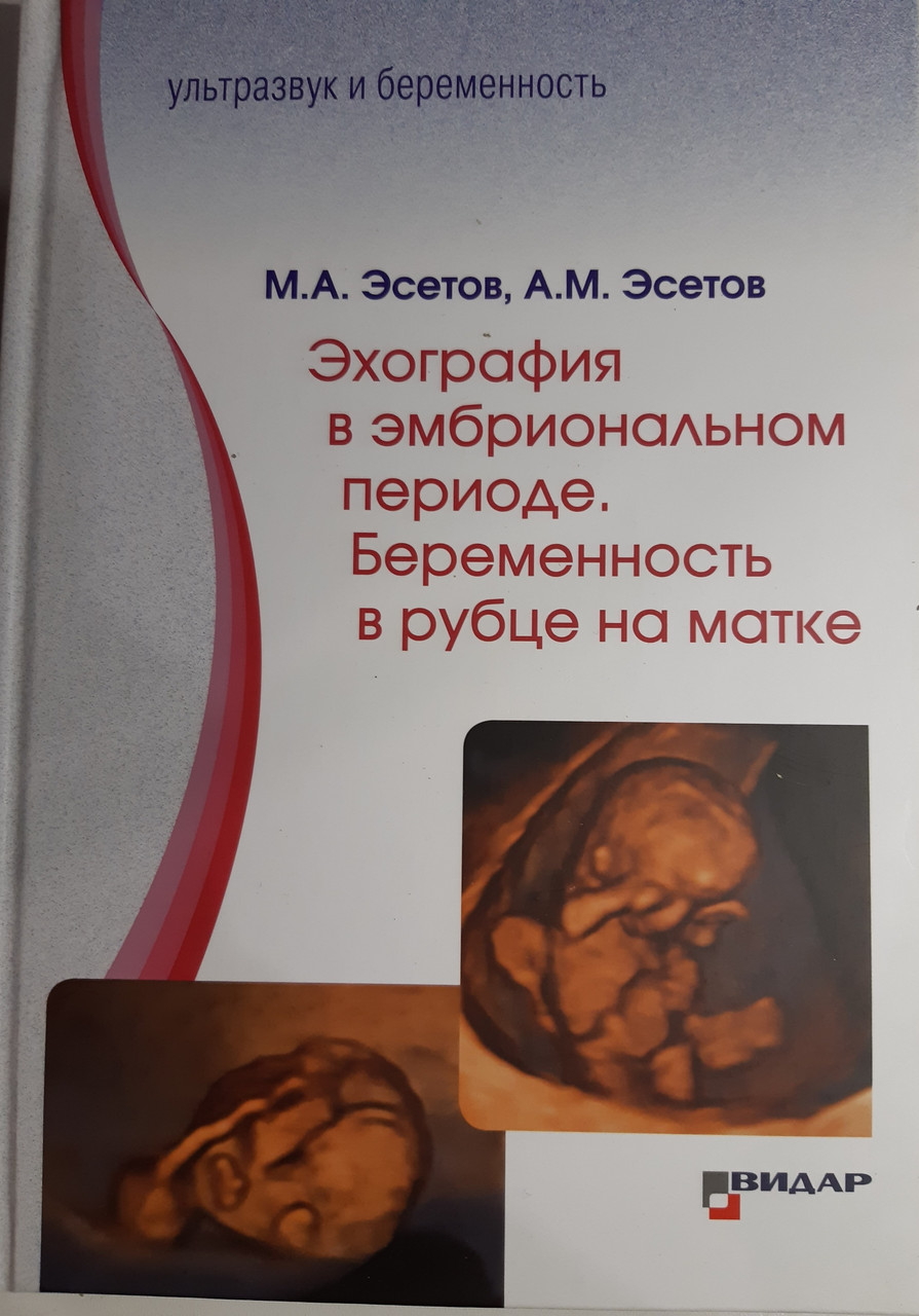 

М.А.Эсетов, А.М.Эсетов. Эхография в эмбриональном периоде. Беременность в рубце на матке 2020 год (978-5-88429-256-7) Изд. Видар-М