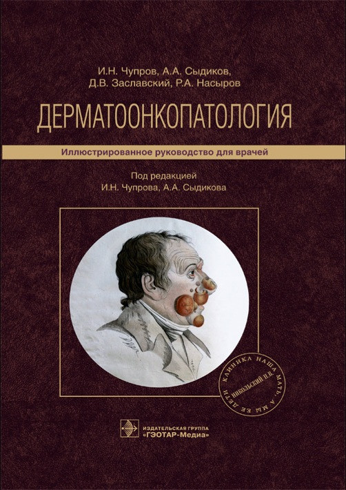 

Чупров И.Н Дерматоонкопатология. Иллюстрированное руководство 2021год (978-5-9704-5899-0) Изд. ГЭОТАР-Медиа