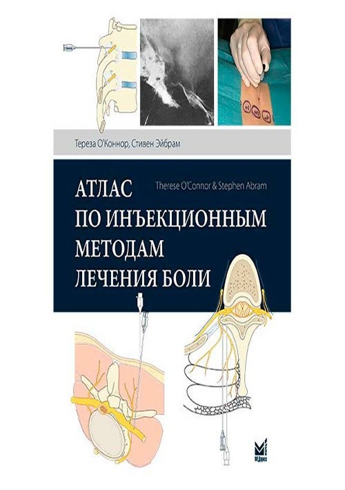 

Оконнор Т.К. Атлас по инъекционным методам лечения боли 2019 год (978-5-00030-716-8) Изд. МЕДпресс-информ