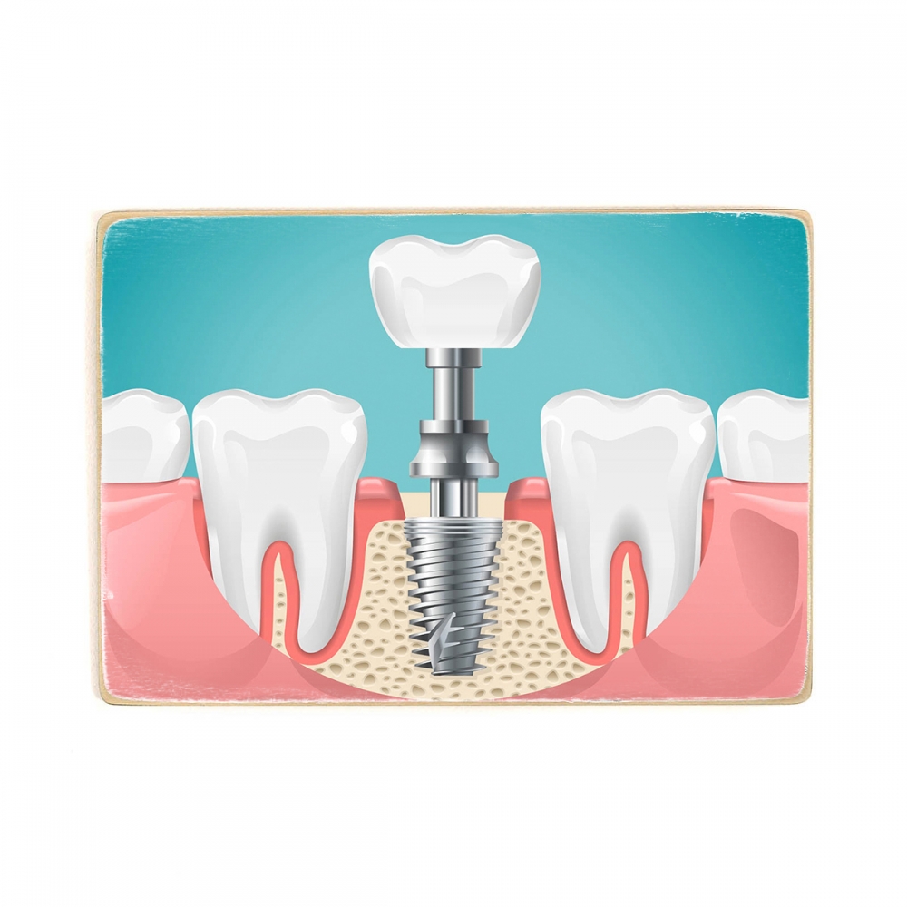 

Деревянный постер Стоматология Dental Surgery А2