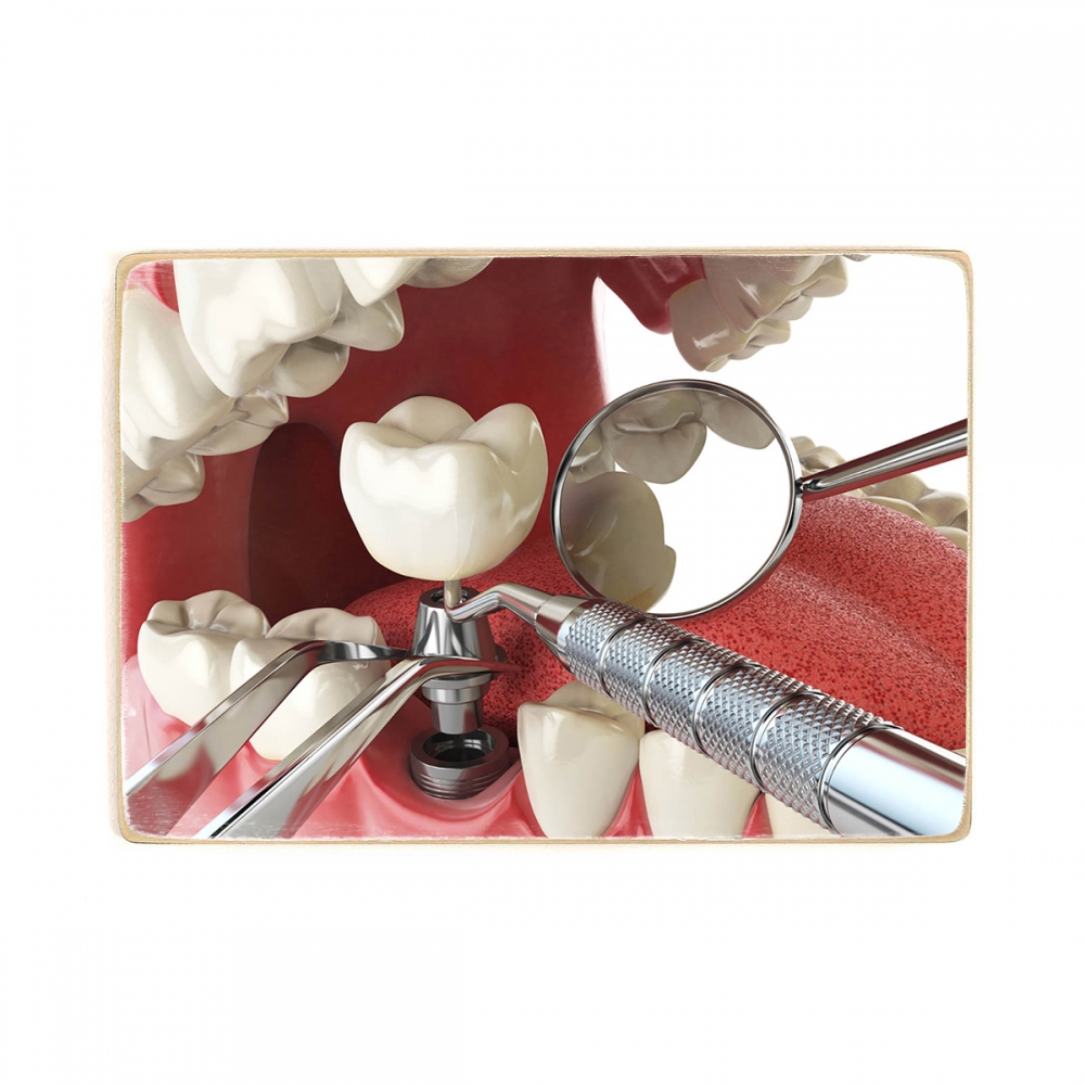 

Деревянный постер Стоматология Dental Implant А1