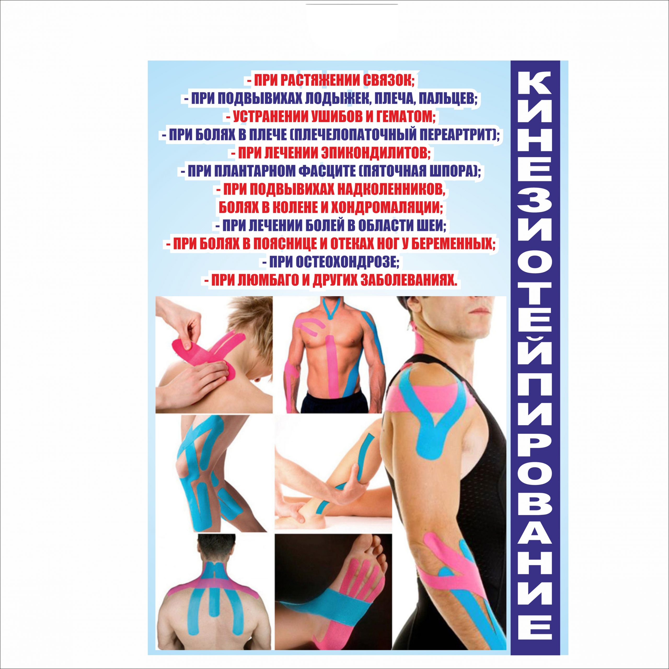 

Плакат Beauty Special “Кинезиотейпирование” А0 (a8224c-8203-3)