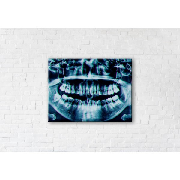 

Картина на холсте прямоугольная I-Art X-ray Image 45x60см